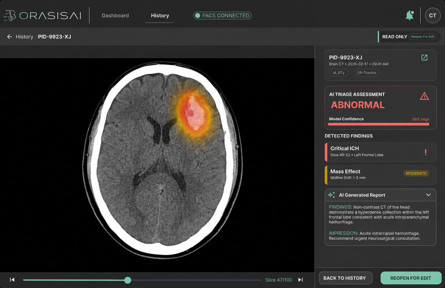 The Orasis AI radiology reading workspace showing a non-contrast head CT with AI insights