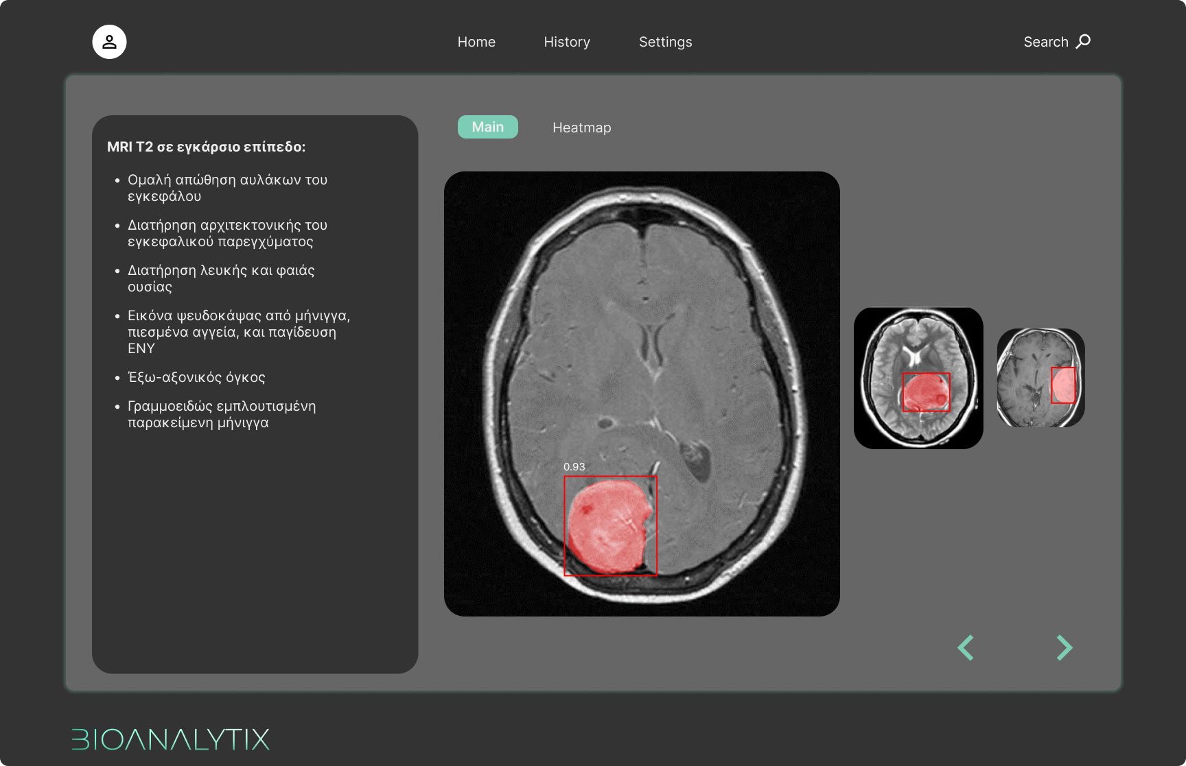 AI Analysis Interface - Medical software with X-ray analysis